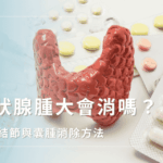 甲狀腺腫大會消嗎?放射科醫師詳解結節與囊腫的消除方法