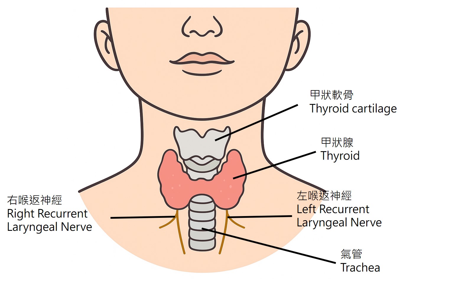 甲狀腺結節位置